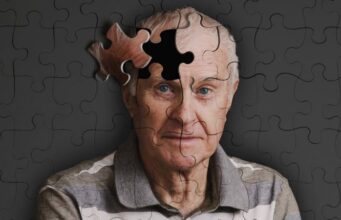 ¿Qué ocurre en el cerebro de las personas con alzhéimer y cómo afecta a su comunicación?